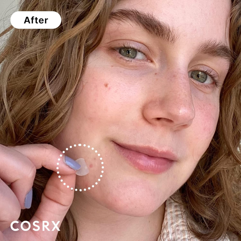 Cosrx Acne Pimple Master Patch 24's Pack